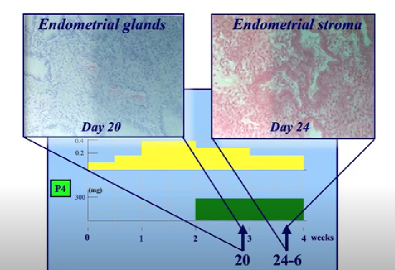 Фото Новые формы введения прогестерона: кому назначаем?